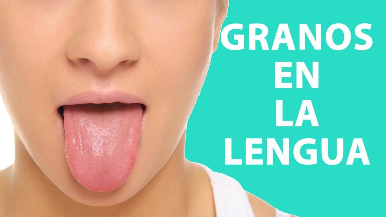 granos en la lengua