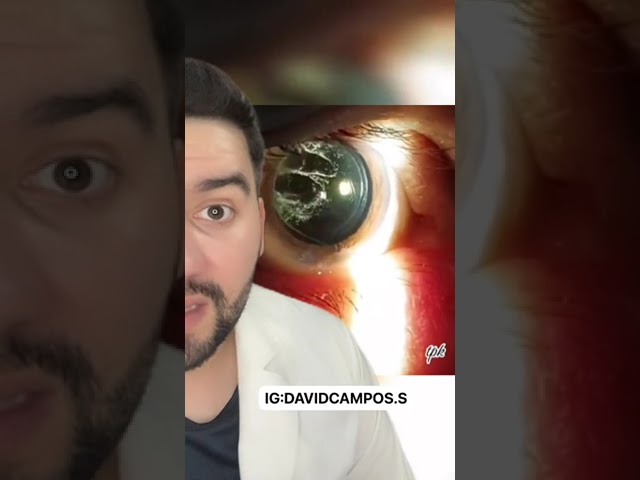 grasa en el ojo