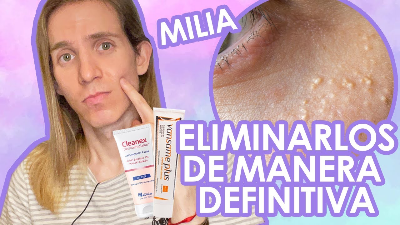 bolita de grasa en el ojo