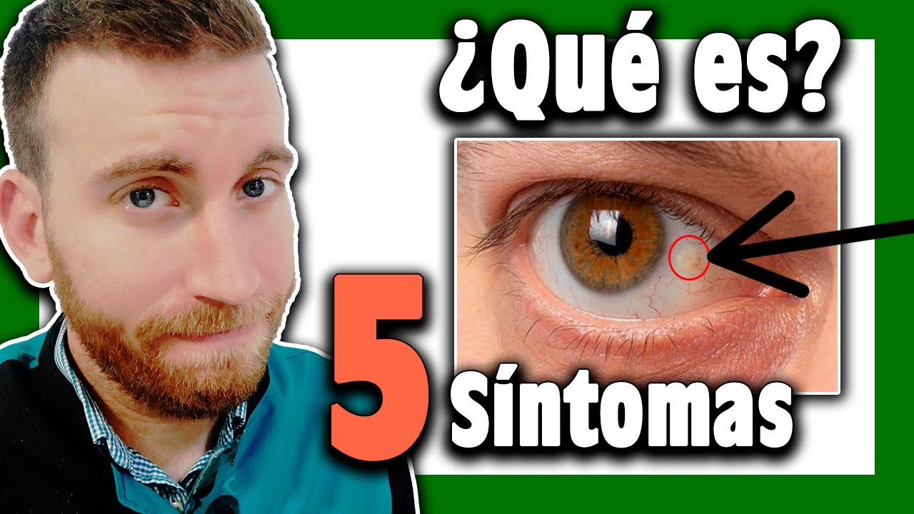 bulto de grasa en el ojo