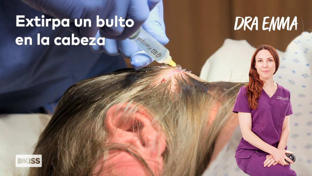 bulto en la cabeza