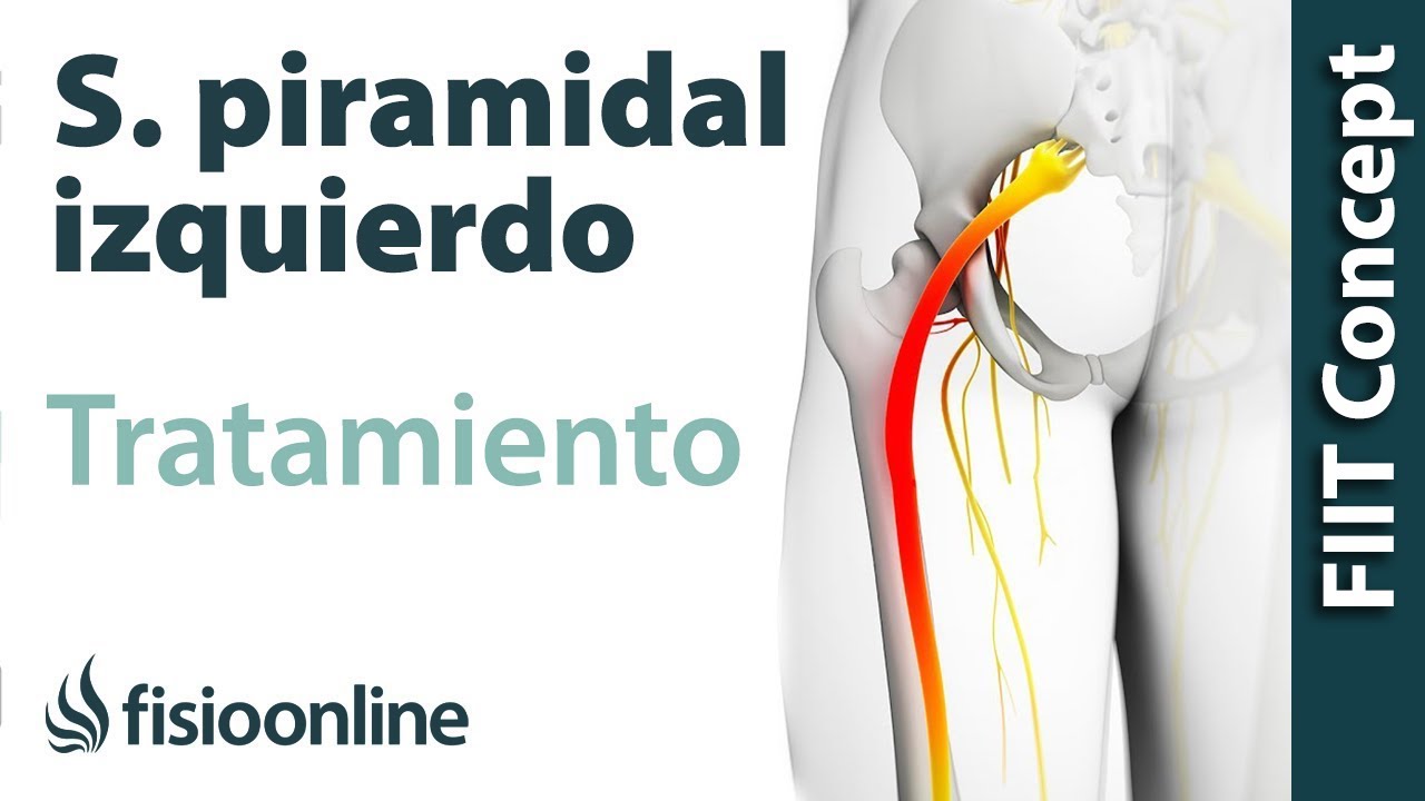dolor de gluteo izquierdo