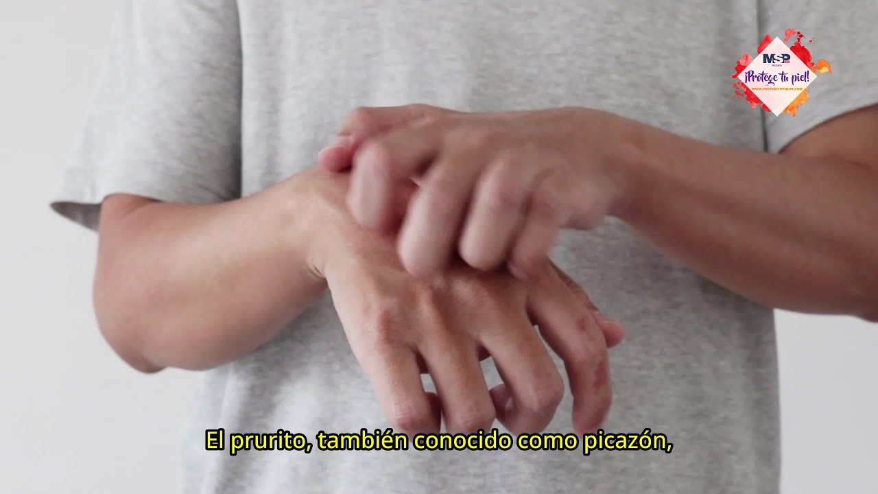 picores por todo el cuerpo en primavera