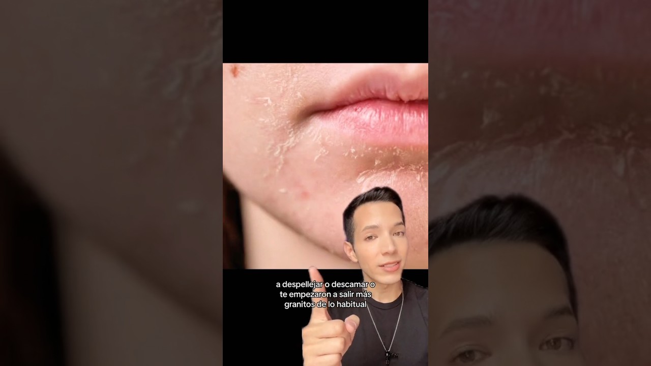 retinol antes y despues