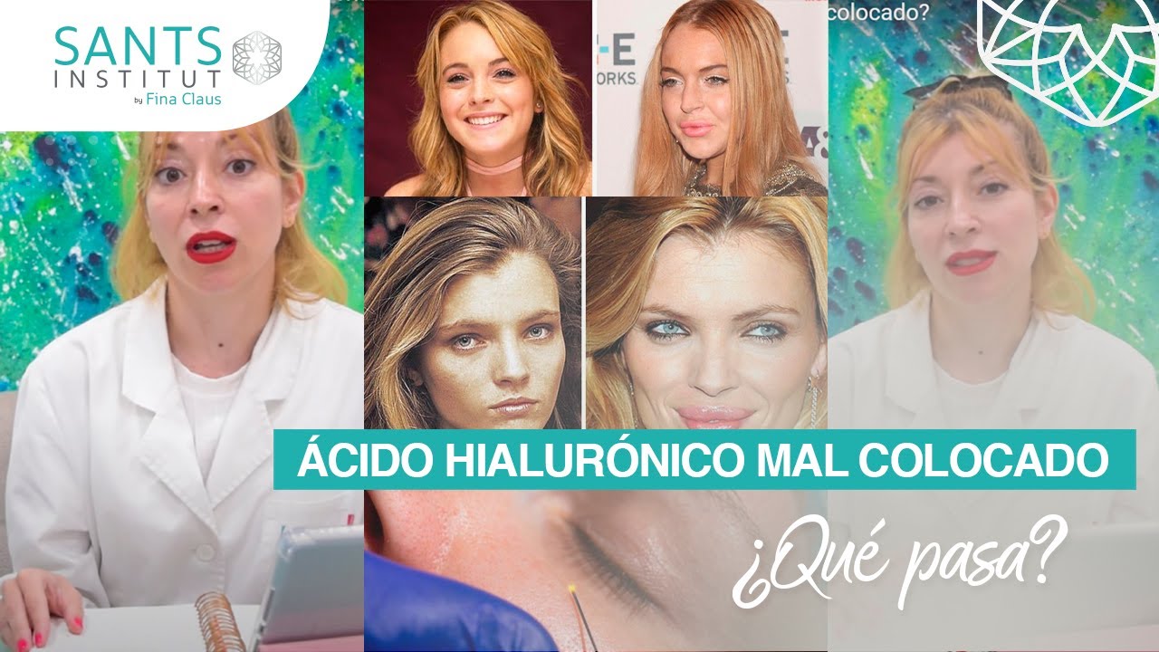 acido hialuronico encapsulado en labios