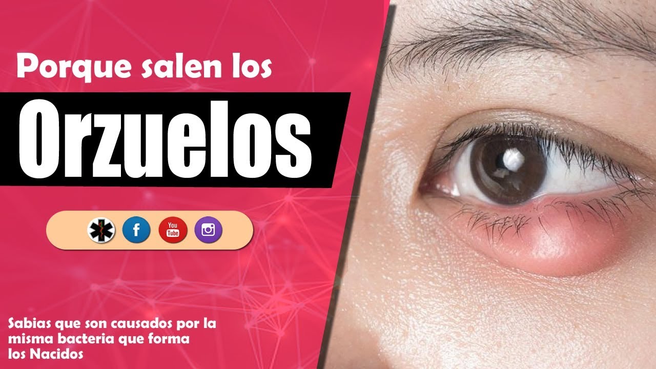 bultitos en los ojos