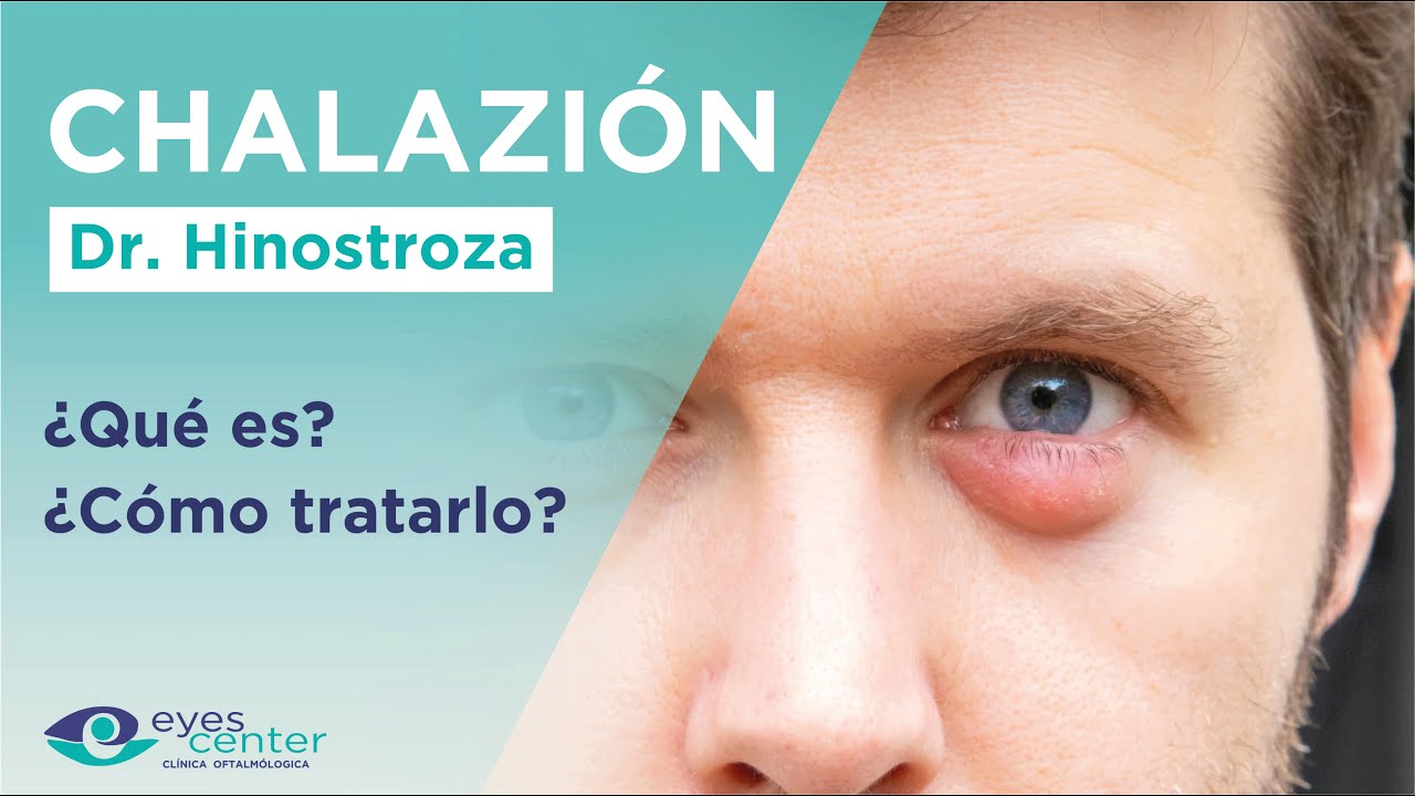 bulto en el ojo por dentro del párpado