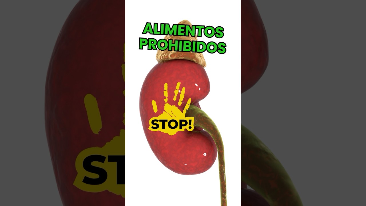 cólico nefrítico alimentos prohibidos
