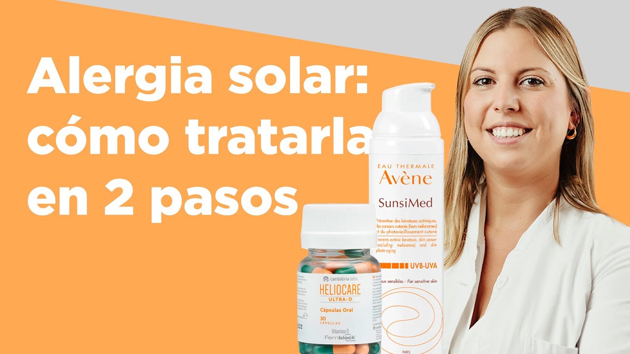 cremas para alergias al sol