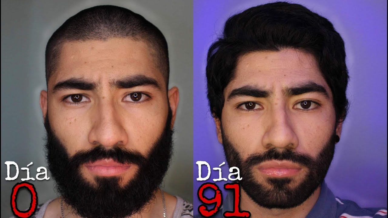 cuanto crece el pelo en tres meses