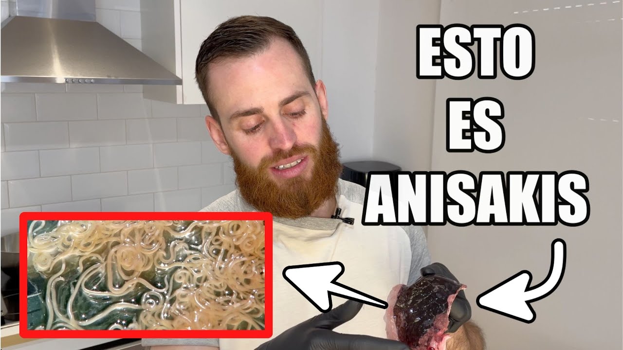 el atun tiene anisakis