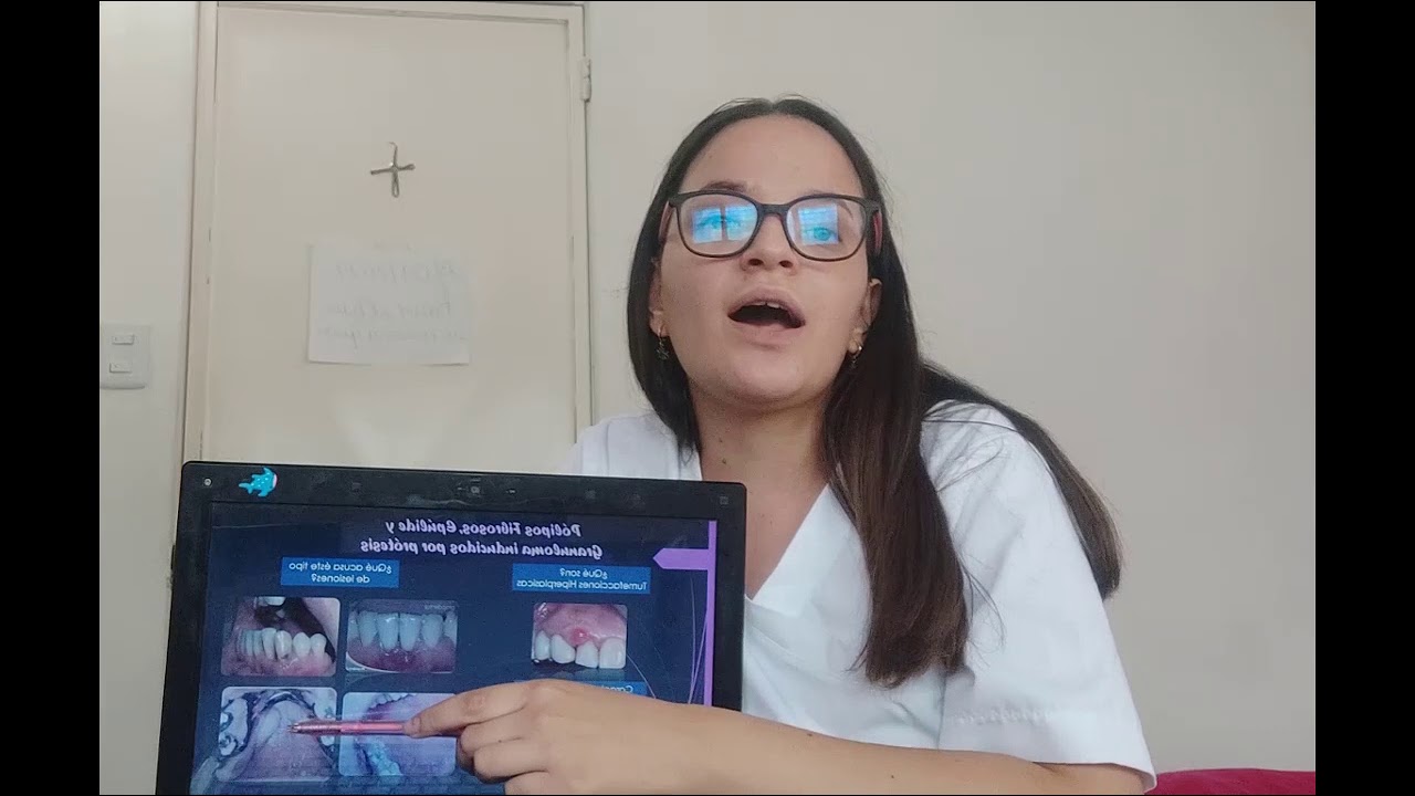 polipos fibroepiteliales