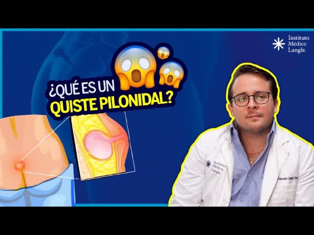 quiste pilonidal desaparece solo