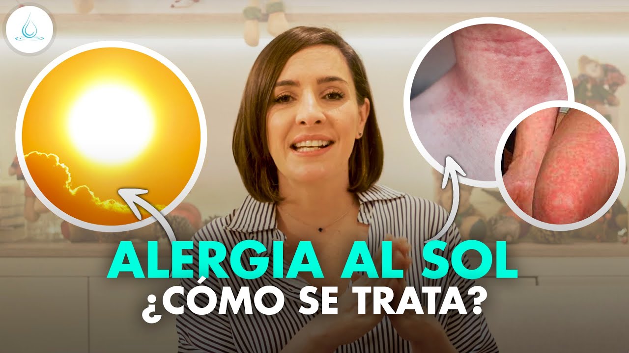 reacción al sol granitos