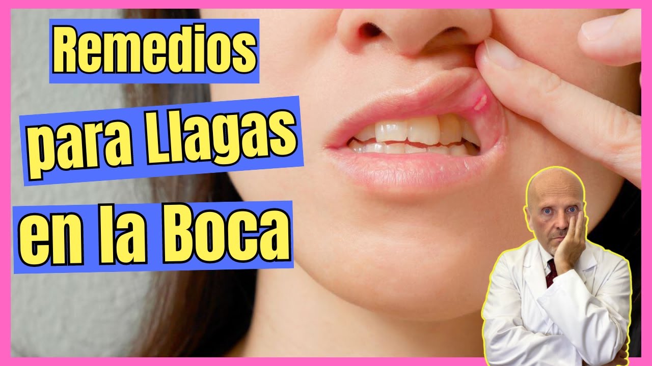 remedio casero para curar llaga en la lengua