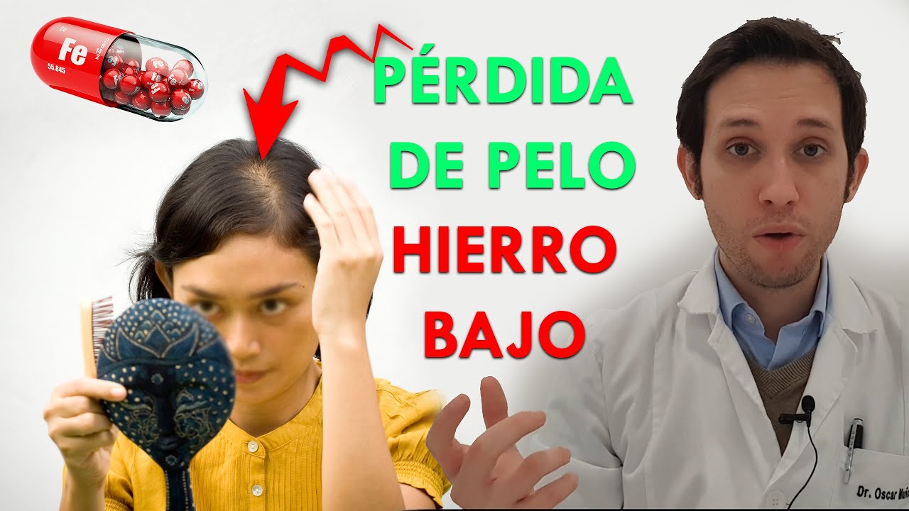 anemia se cae el pelo