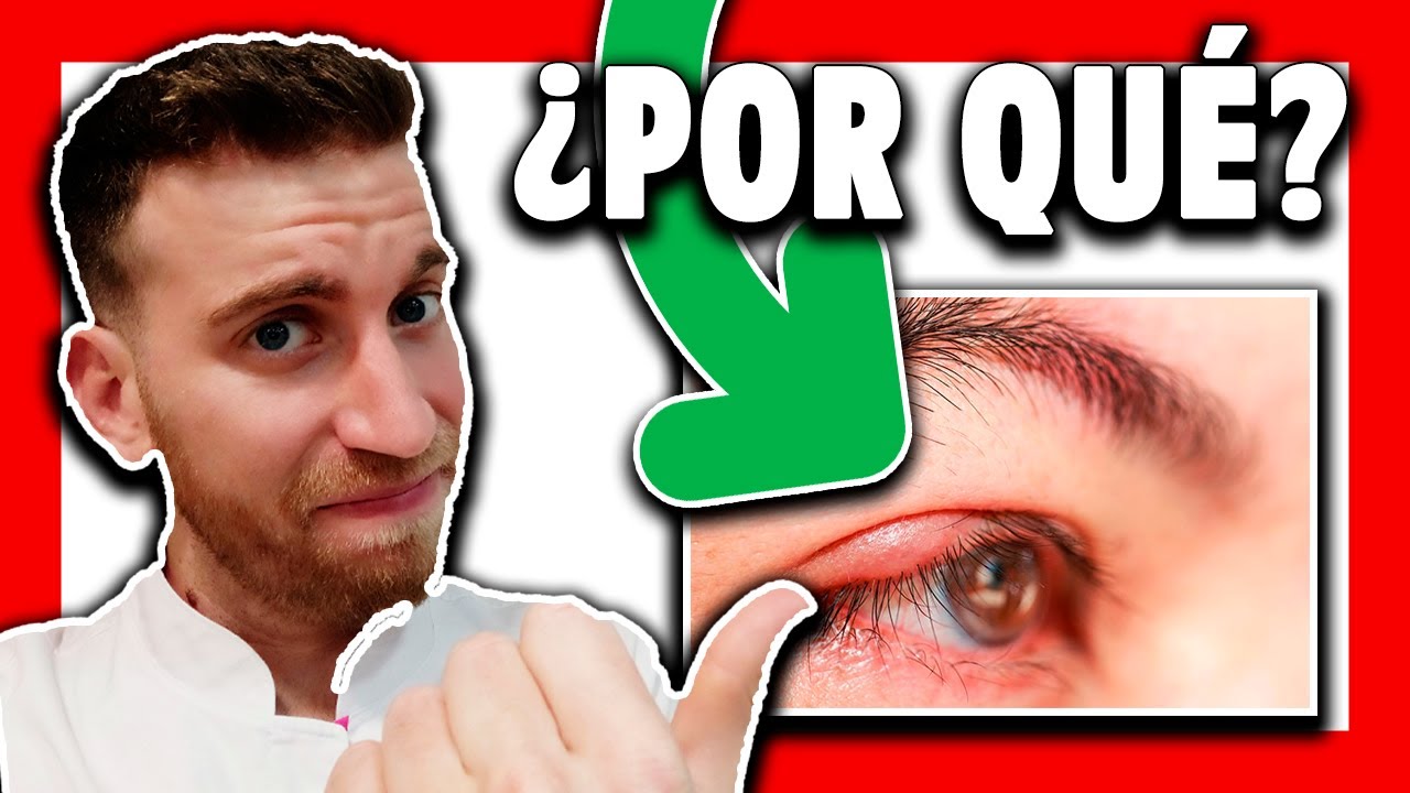 bulto en el párpado