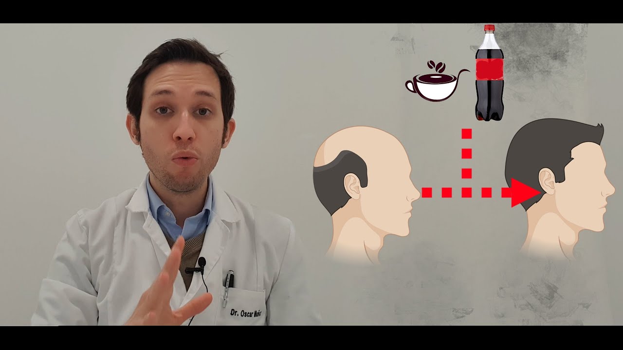 cafeina para el pelo