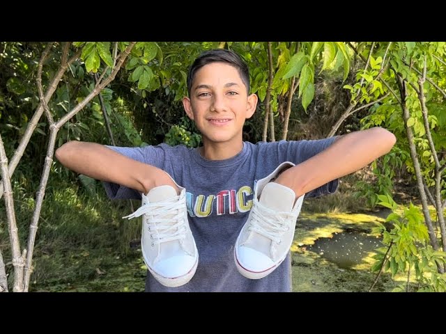 como quitar desteñido en zapatillas blancas