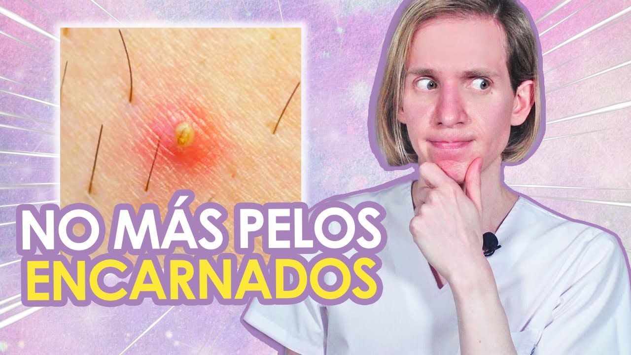 como quitar un pelo encarnado