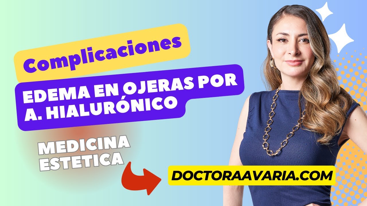 edema en ojeras por ácido hialurónico