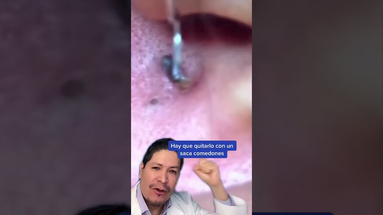 grano en la oreja por dentro