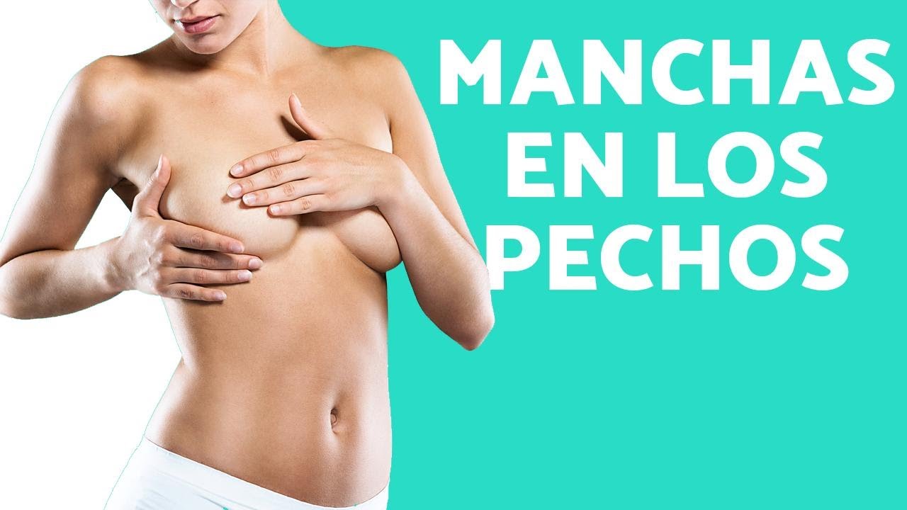 manchas pecho mujer